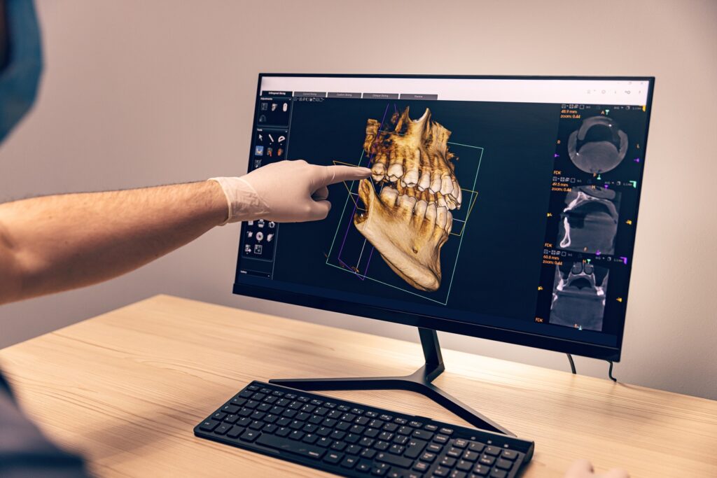 3D Baskı ve Estetik Diş Hekimliği: Modern Kliniklerde Uygulama Örnekleri